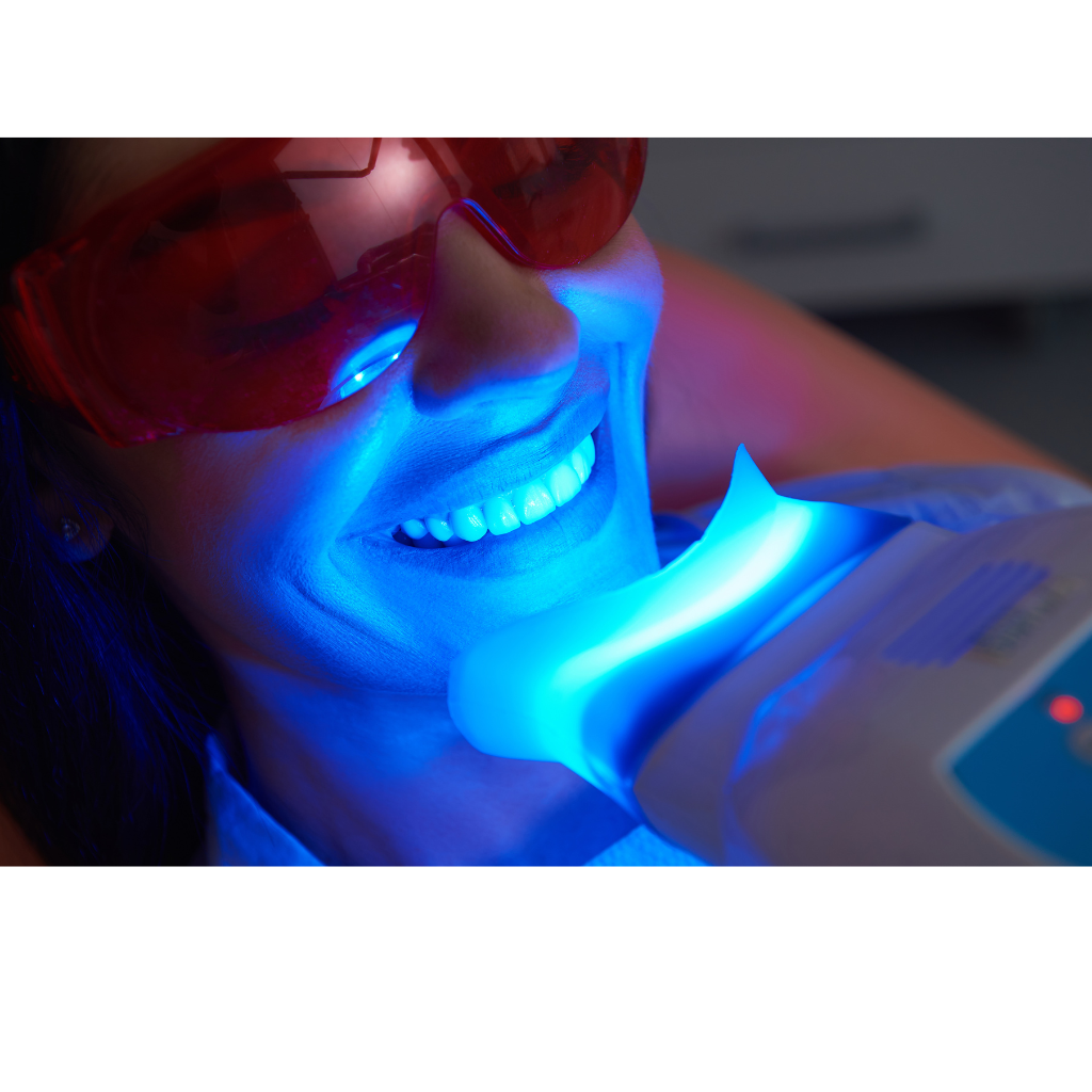 Professional Whitening