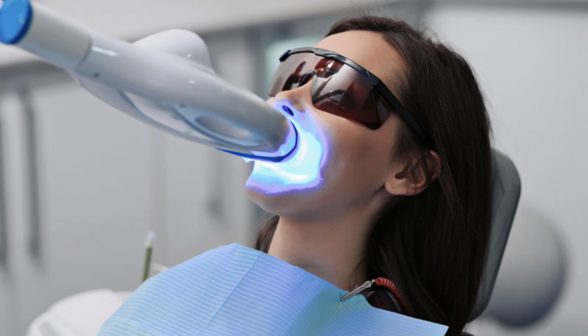 Professional Whitening